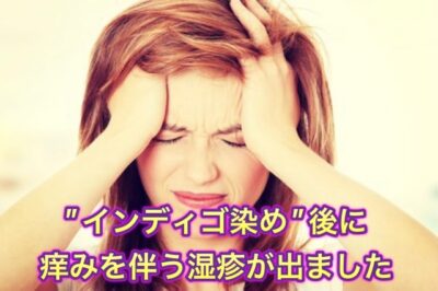 【インディゴ染め】後に痒みを伴う湿疹が出ました…