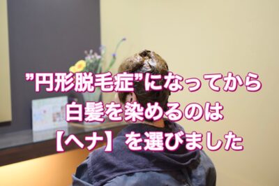 "円形脱毛症”になってから白髪を染めるのは【ヘナ】を選びました