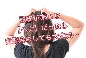 頭皮が赤い!?【ヘナ】だったら”白髪染め”しても大丈夫…