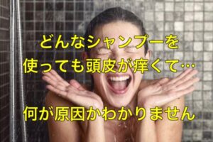 どんなシャンプーを使っても頭皮が痒くて…何が原因かわかりません